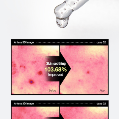 Alternative view of Phyto-calm Serum