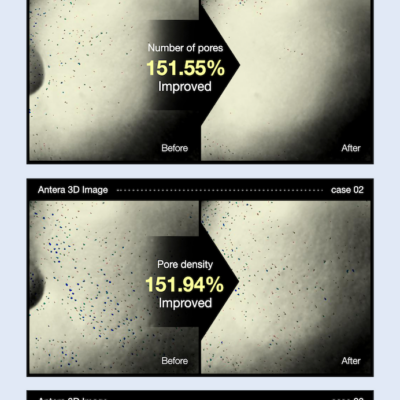 Porefit water - Image 4